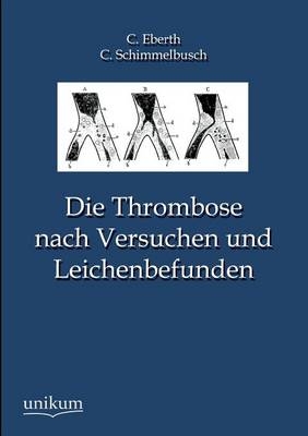 Die Thrombose nach Versuchen und Leichenbefunden - C. Eberth, C. Schimmelbusch