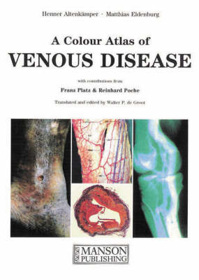 A Colour Atlas of Venous Disease - 