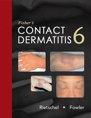 Fisher's Contact Dermatitis - Robert Rietschel, Joseph Fowler