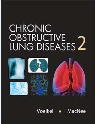 Chronic Obstructive Lung Diseases - Norbert Voelkel, William MacNee