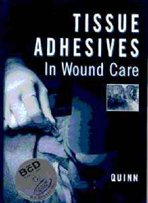 Tissue Adhesives in Wound Care - James B. Quinn