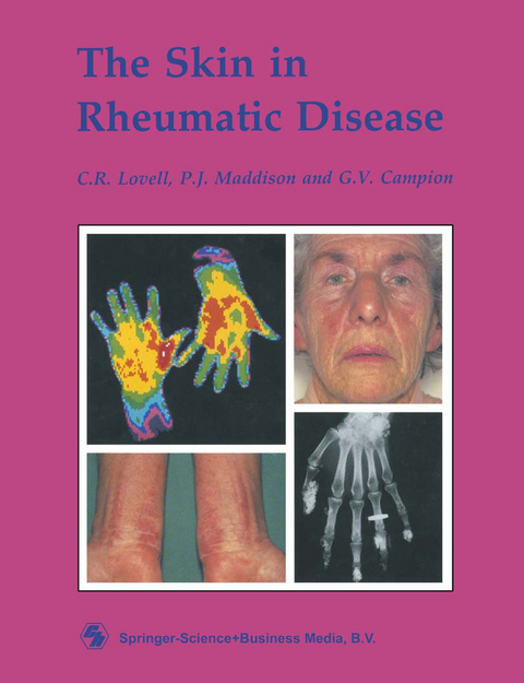 The Skin in Rheumatic Disease - C. R. Lovell, G. V. Campion, P. J. Maddison