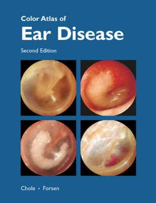 Colour Atlas of Ear Disease - Richard A. Chole, James W. Forsen