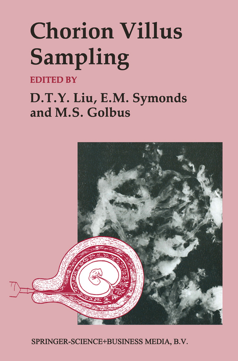 Chorion Villus Sampling - Mitchell S. Golbus, D. T. Y. Liu, E. M. Symonds