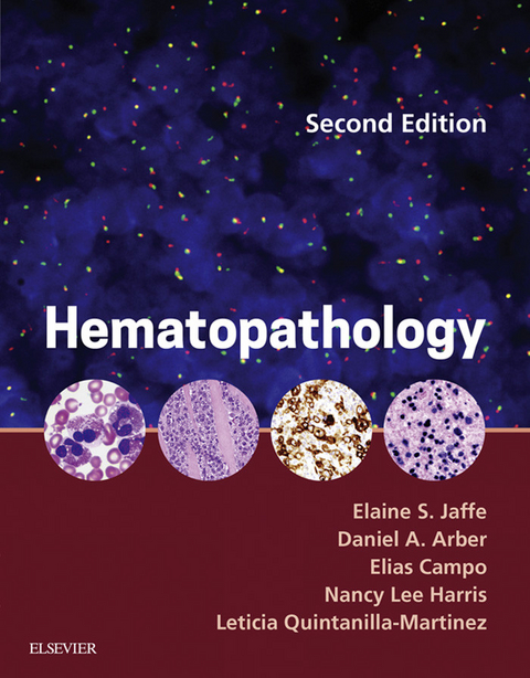 Hematopathology -  Daniel A. Arber,  Elias Campo,  Elaine Sarkin Jaffe,  Attilio Orazi,  Leticia Quintanilla-Fend