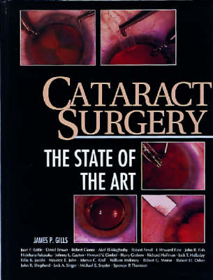 Cataract Surgery - James P. Gills, Donald R. Sanders