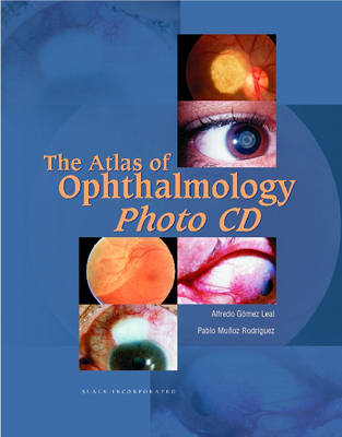 The Atlas of Ophthalmology Photo CD - Alfredo Gomez Leal, Pablo Munoz Rodriguez