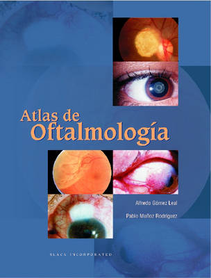 The Atlas of Ophthalmology - Alfredo Gomez Leal, Pablo Munoz Rodriguez