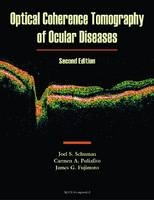 Optical Coherence Tomography of Ocular Diseases - Joel S. Schuman, Carmen A. Puliafito, James G. Fujimoto