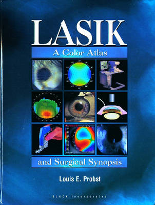 LASIK - Louis E. Probst