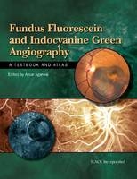 Fundus Fluorescein and Indocyanine Green Angiography - Amar Agarwal