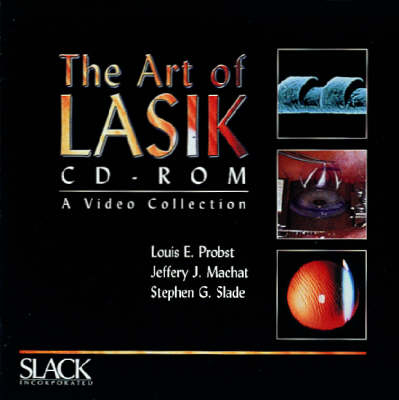 The Art of LASIK - Jeffrey Machat, Stephen Slade, Louis Probst
