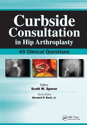 Curbside Consultation in Hip Arthroplasty - Scott Sporer