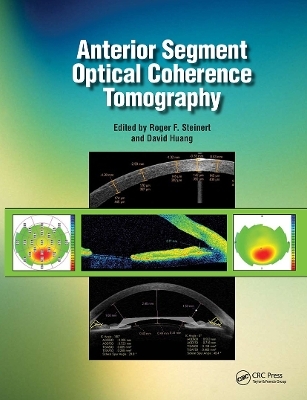 Anterior Segment Optical Coherence Tomography - Roger Steinert, David Huang