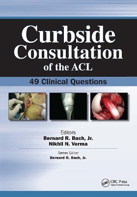 Curbside Consultation of the ACL - 