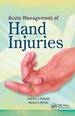 Acute Management of Hand Injuries - Andrew Weiland, Rachel Rohde