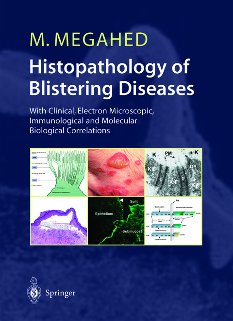 Histopathology of Blistering Diseases - Mosaad Megahed
