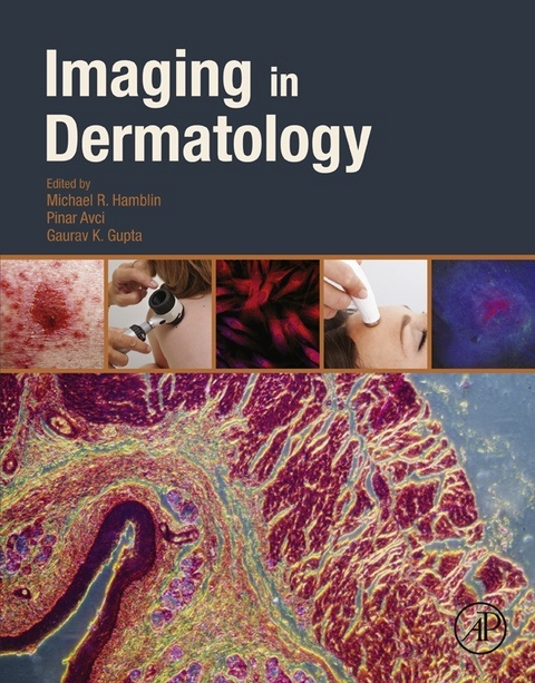 Imaging in Dermatology - 