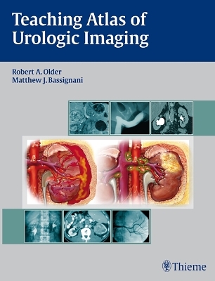 Teaching Atlas of Urologic Imaging - 