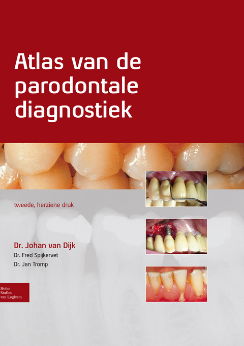 Atlas van de parodontale diagnostiek -  Johan van Dijk,  Fred Spijkervet,  Jan Tromp