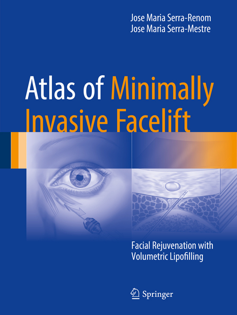 Atlas of Minimally Invasive Facelift -  Jose Maria Serra-Renom,  Jose Maria Serra-Mestre