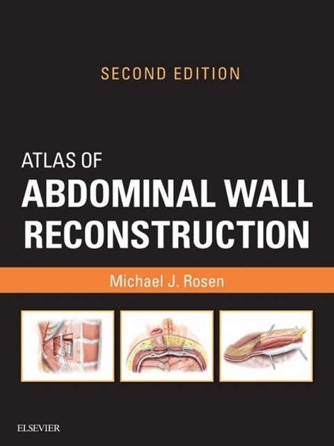 Atlas of Abdominal Wall Reconstruction -  Michael J. Rosen
