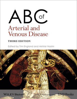 ABC of Arterial and Venous Disease - 