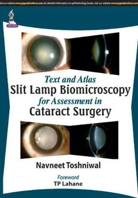 Text and Atlas: Slit Lamp Biomicroscopy for Assessment in Cataract Surgery - Navneet Toshniwal