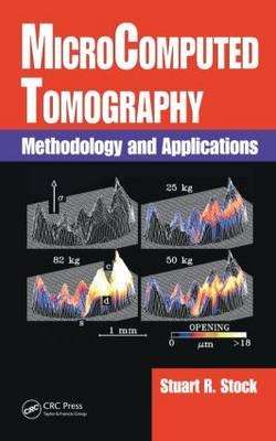 MicroComputed Tomography - Stuart R. Stock