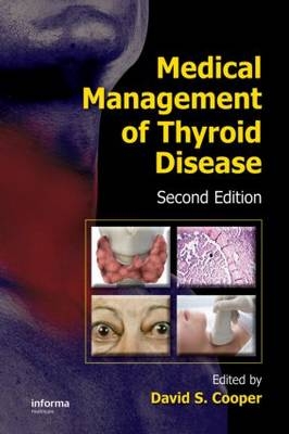 Medical Management of Thyroid Disease - 