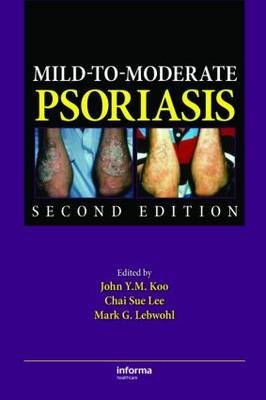 Mild-to-Moderate Psoriasis - 