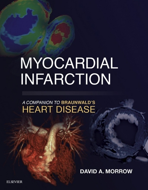 Myocardial Infarction: A Companion to Braunwald's Heart Disease E-Book -  David A Morrow