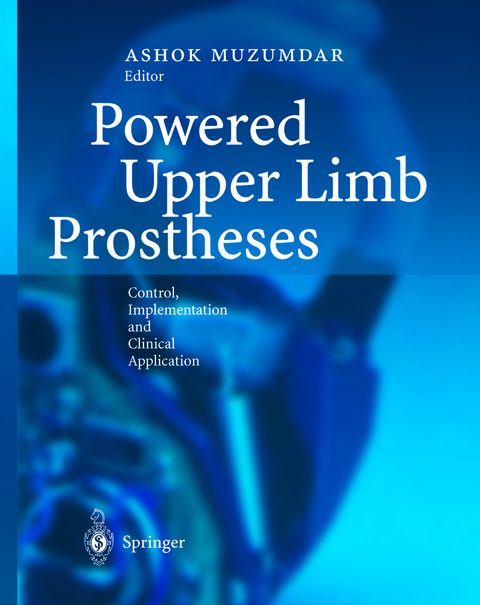 Powered Upper Limb Prostheses - 