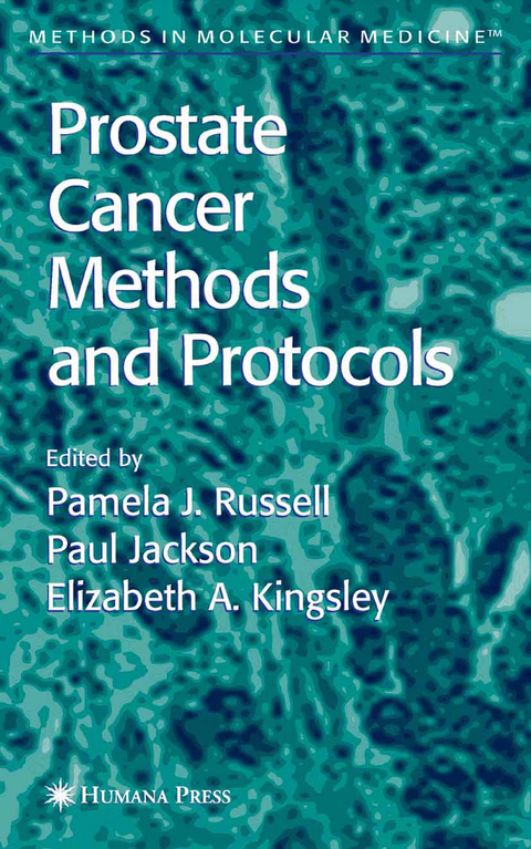 Prostate Cancer Methods and Protocols - 