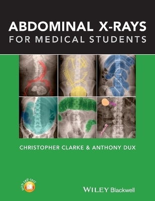 Abdominal X-rays for Medical Students - Christopher Clarke, Anthony Dux