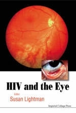 Hiv And The Eye - 