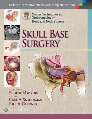 Master Techniques in Otolaryngology - Head and Neck Surgery: Skull Base Surgery - Carl Snyderman, Paul Gardner