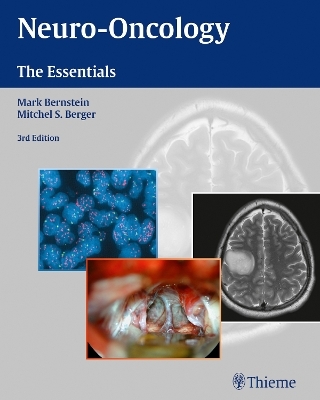 Neuro-Oncology: The Essentials - 