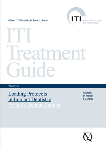 Loading Protocols in Implant Dentistry - Jeffrey Ganeles, Dean Morton