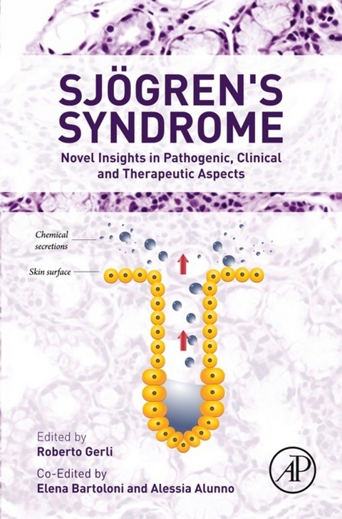 Sjogren's Syndrome - 