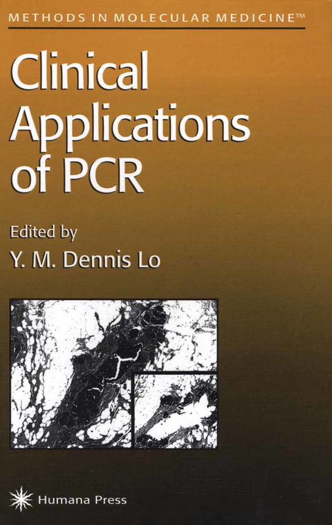 Clinical Applications of PCR - 