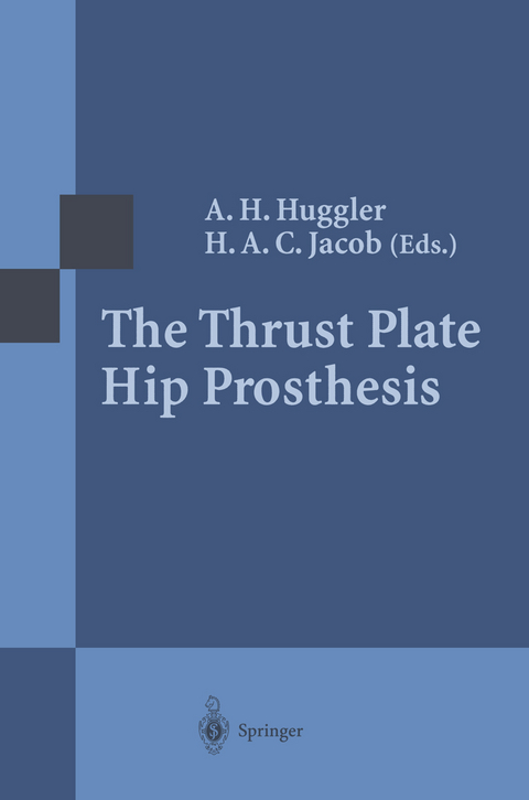 The Thrust Plate Hip Prosthesis - 