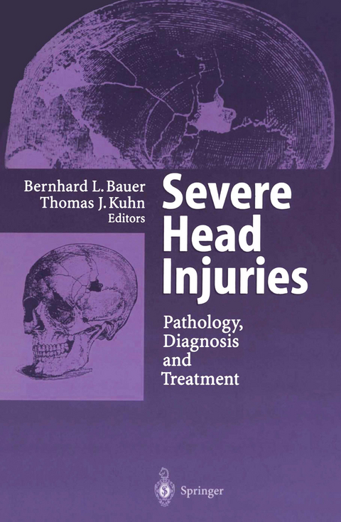 Severe Head Injuries - 