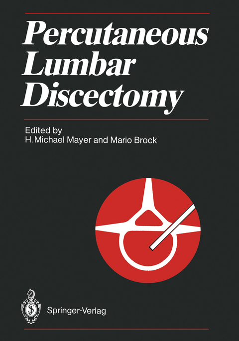 Percutaneous Lumbar Discectomy - 