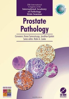 Prostate Pathology - Hema Samaratunga, Jonathan Epstein