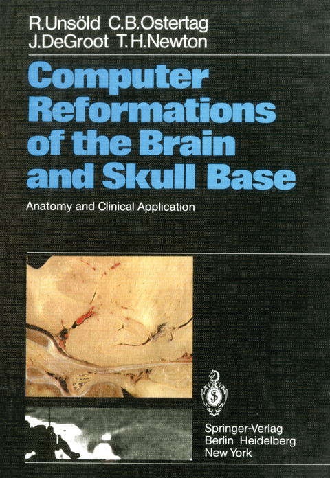 Computer Reformations of the Brain and Skull Base - R. Unsöld, C. B. Ostertag, J. DeGroot, T. H. Newton