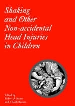 Shaking and Other Non-Accidental Head Injuries in Children - Robert A. Minns, J. Keith Brown