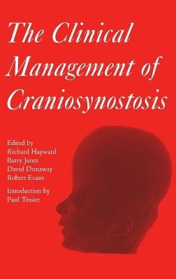 The Clinical Management of Craniosynostosis - 