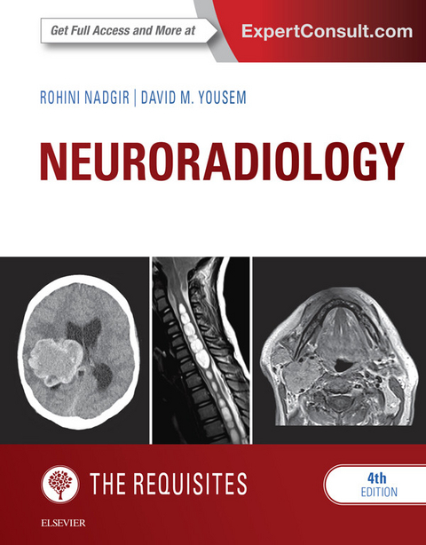 Neuroradiology: The Requisites -  Rohini Nadgir,  David M. Yousem