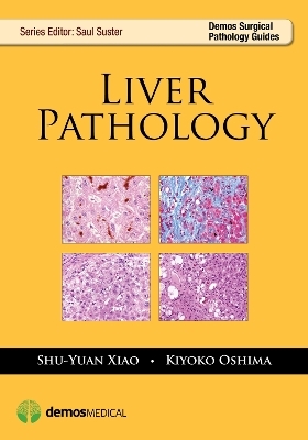 Liver Pathology - Shu-Yuan Xiao, Kiyoko Oshima